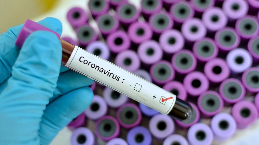 Na KiM 144 nova slučaja koronavirusa