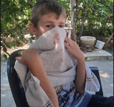 Otac dečaka koji je napadnut u Kosovskoj Kamenici: Pošalješ dete u prodavnicu dođe obliven krvlju