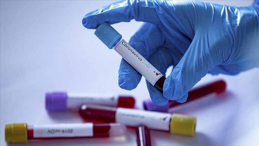 U ambulantama u Ranilugu i Pasjanu registrovano 75 inficiranih koronavirusom, dve osobe preminule