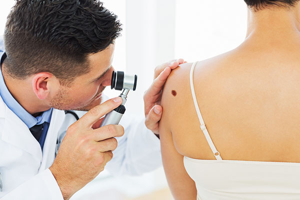 Prof. dr Milijana Relić: Samopregledi i dermoskopija ključni u otkrivanju melanoma